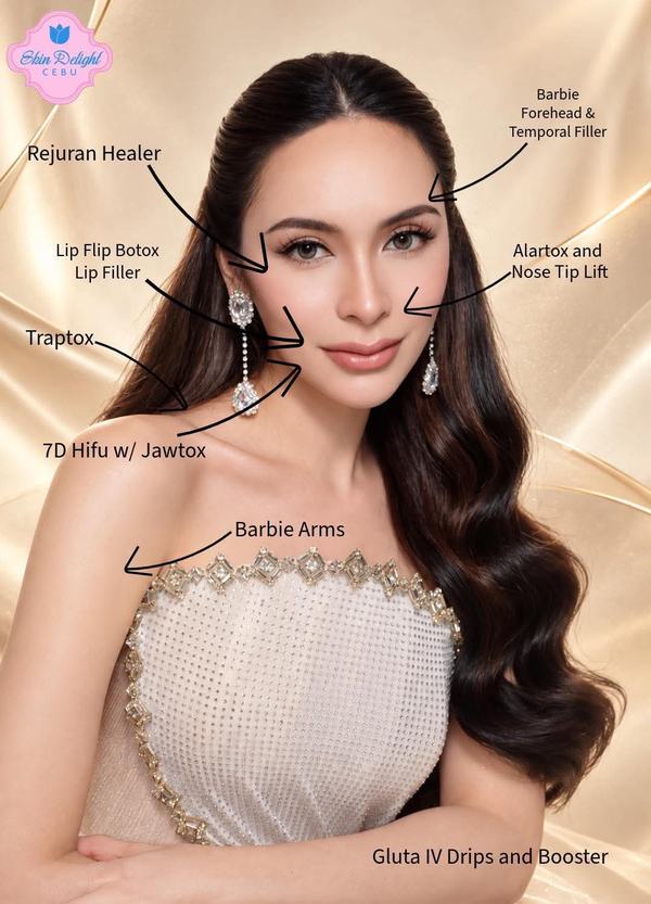 Skin Delight Cebu client in a beige gown, labeled with the treatments the client had with us: Rejuran Healer, Barbie forehead and temporal filler, lip flip Botox and lip filler, Alartox and nose tip lift, Traptox, 7D HIFU with Jawtox, Barbie arms, and Gluta IV drips and booster