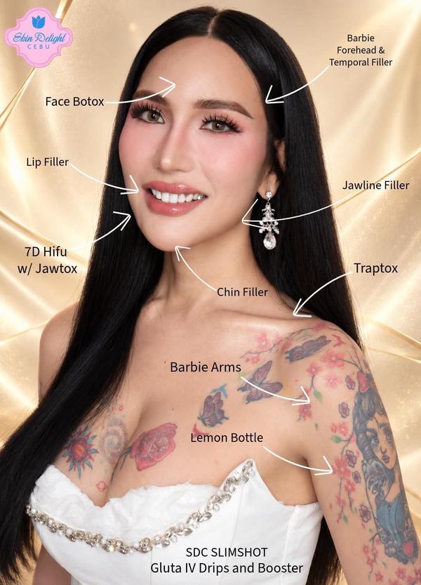 Skin Delight Cebu client in a white gown, labeled with the treatments the client had with us: face Botox, Barbie forehead and temporal filler, lip filler, jawline filler, chin filler, 7D HIFU with Jawtox, Traptox, Barbie arms, Lemon Bottle, SDC Slimshot, and Gluta IV drips and booster